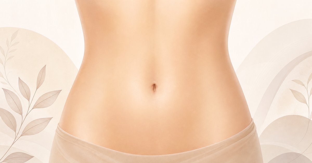 Ilustração da região do umbigo após abdominoplastia